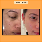 Crème Capsule Vitamine C- Anti Taches- Hydratante