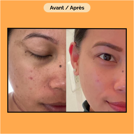 Crème Capsule Vitamine C- Anti Taches- Hydratante