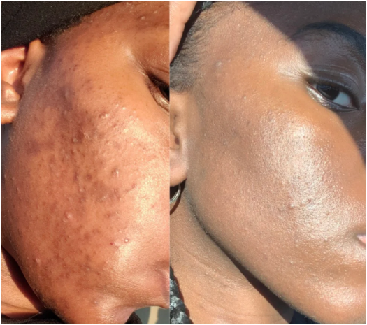 Crème Capsule Vitamine C- Anti Taches- Hydratante