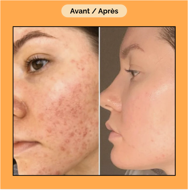 Crème Capsule Vitamine C- Anti Taches- Hydratante