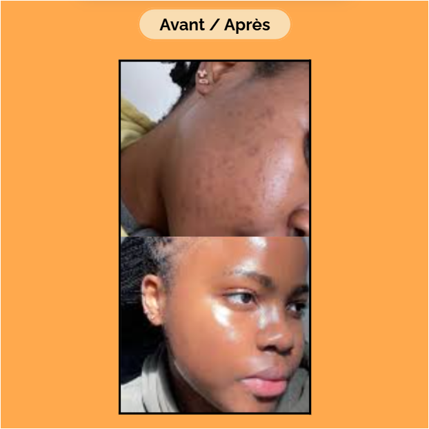 Crème Capsule Vitamine C- Anti Taches- Hydratante