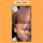 Crème Capsule Vitamine C- Anti Taches- Hydratante