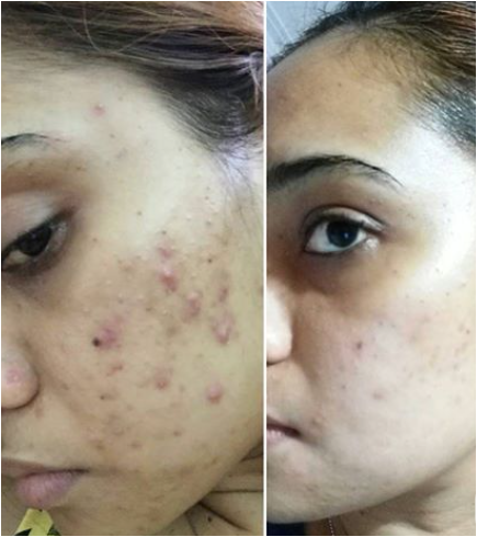 Crème Capsule Vitamine C- Anti Taches- Hydratante