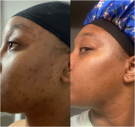 Crème Capsule Vitamine C- Anti Taches- Hydratante