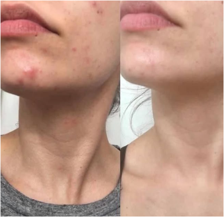 Crème Capsule Vitamine C- Anti Taches- Hydratante